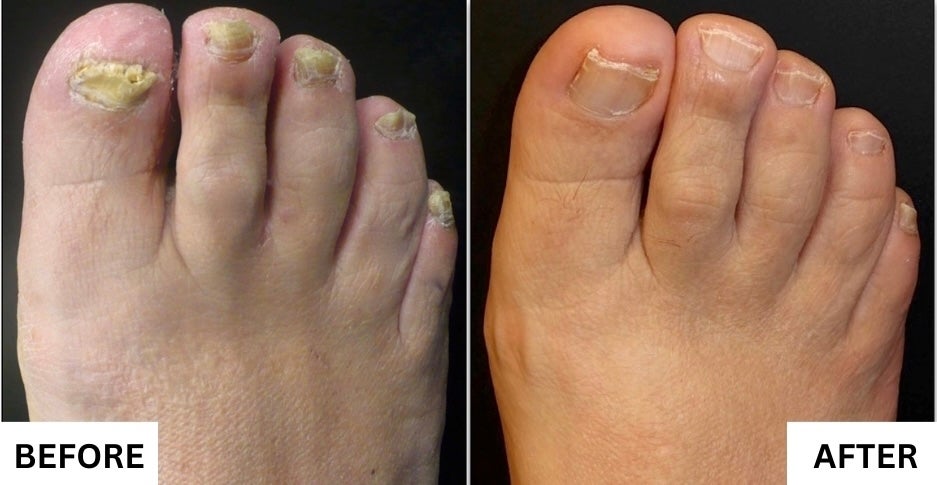 Amanda's before and after results