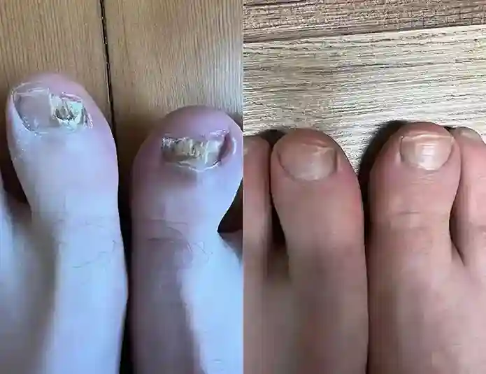 Mike's before and after results