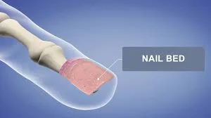 Nail bed diagram