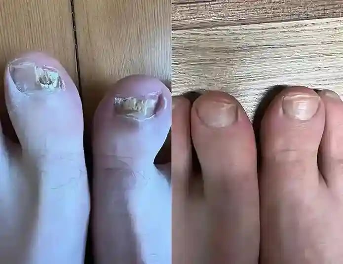 Mike's before and after results